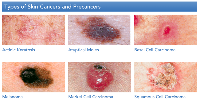 CAPELLA blog post featuring Dr. Munavalli | Dermatology, Laser & Vein ...